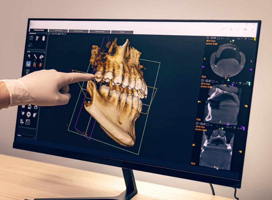 dentist pointing at digital scan of mouth and teeth