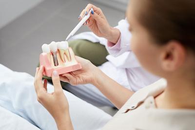 person holding dental implant model
