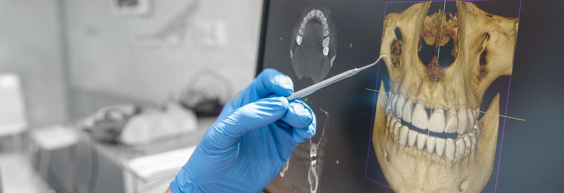 dentist pointing to dental x-ray