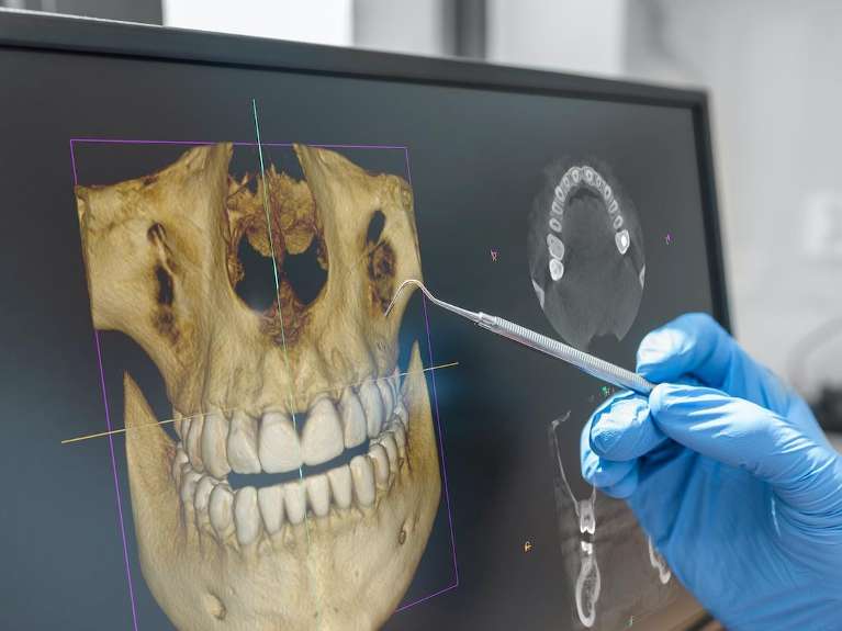 3-D Cone Beam Computed Tomograhy (CBCT)