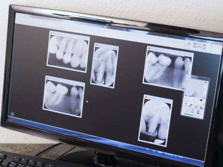 Digital X-Rays & Sensors